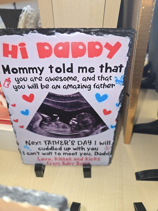 Dad-to-Be Pregnancy Announcement Slate Plaque – Baby Sonogram Gift | Father’s Day or Baby Shower Present